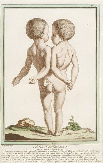 Illustration for article titled Beautiful Portraits of "Monstrosities" from the 18th Century